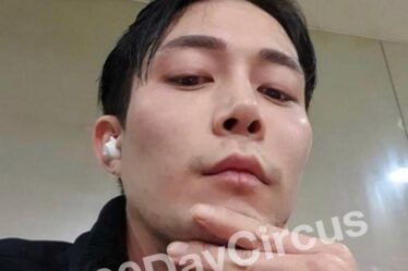 jihoon plastic surgery