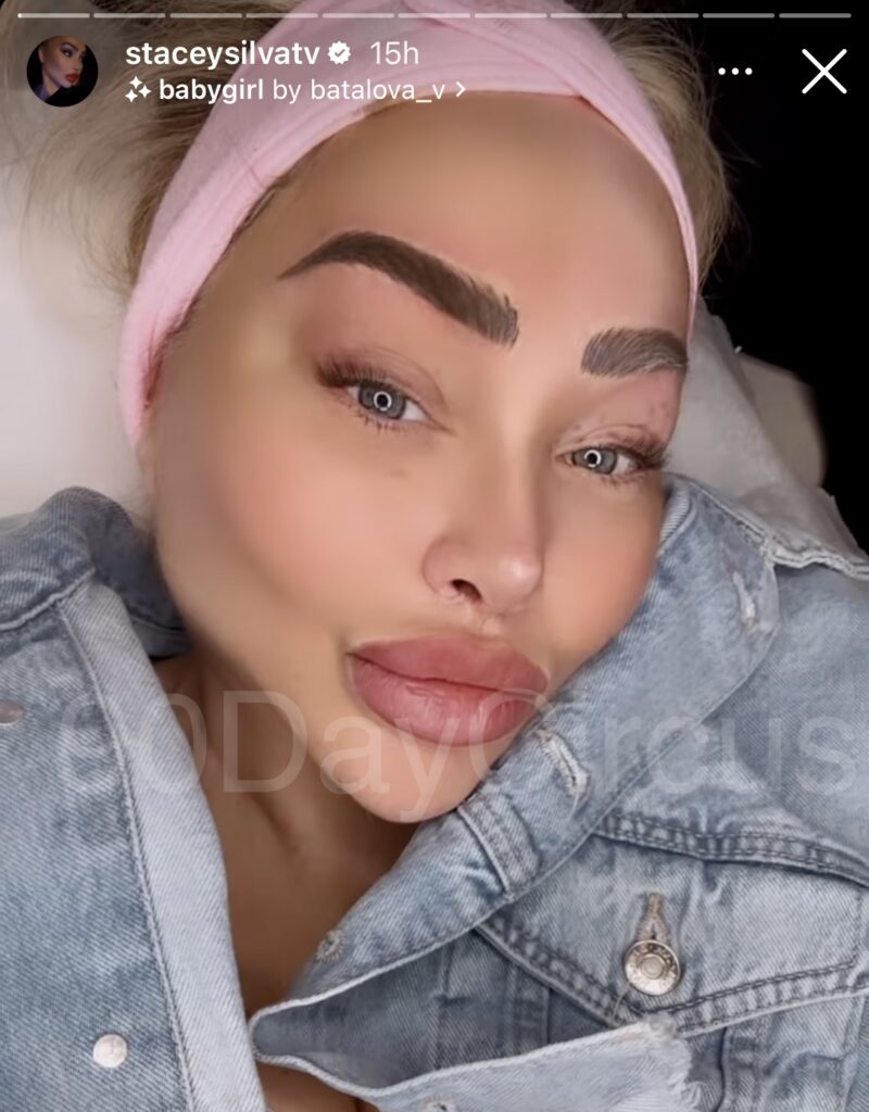 Stacey Silva Cosmetic Procedures