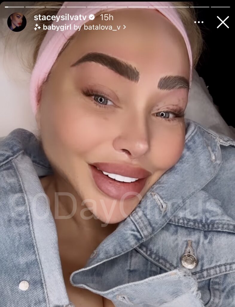 Stacey Silva Cosmetic Procedures