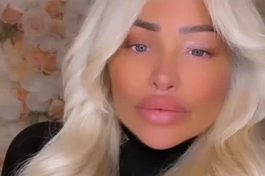Stacey Silva Cosmetic Procedures
