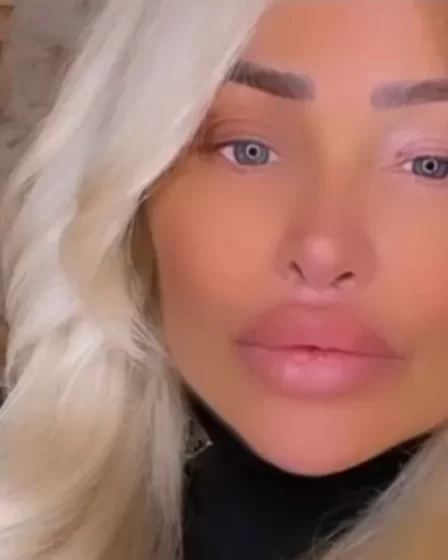 Stacey Silva Cosmetic Procedures