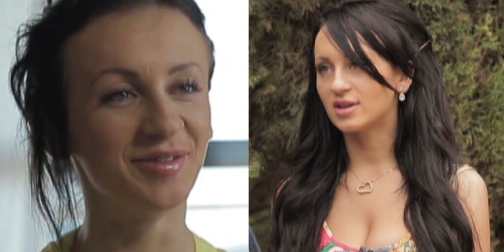 Yara Zaya Plastic Surgery
