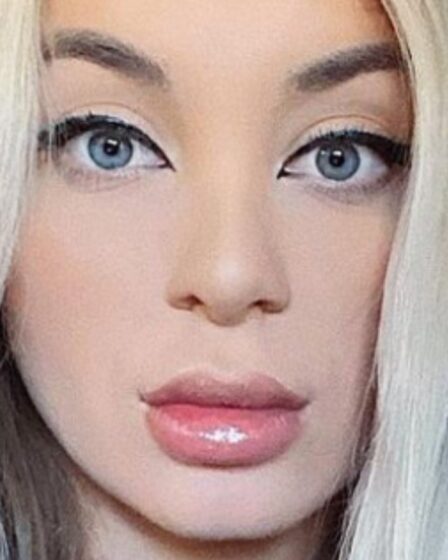 Yara Zaya Plastic Surgery