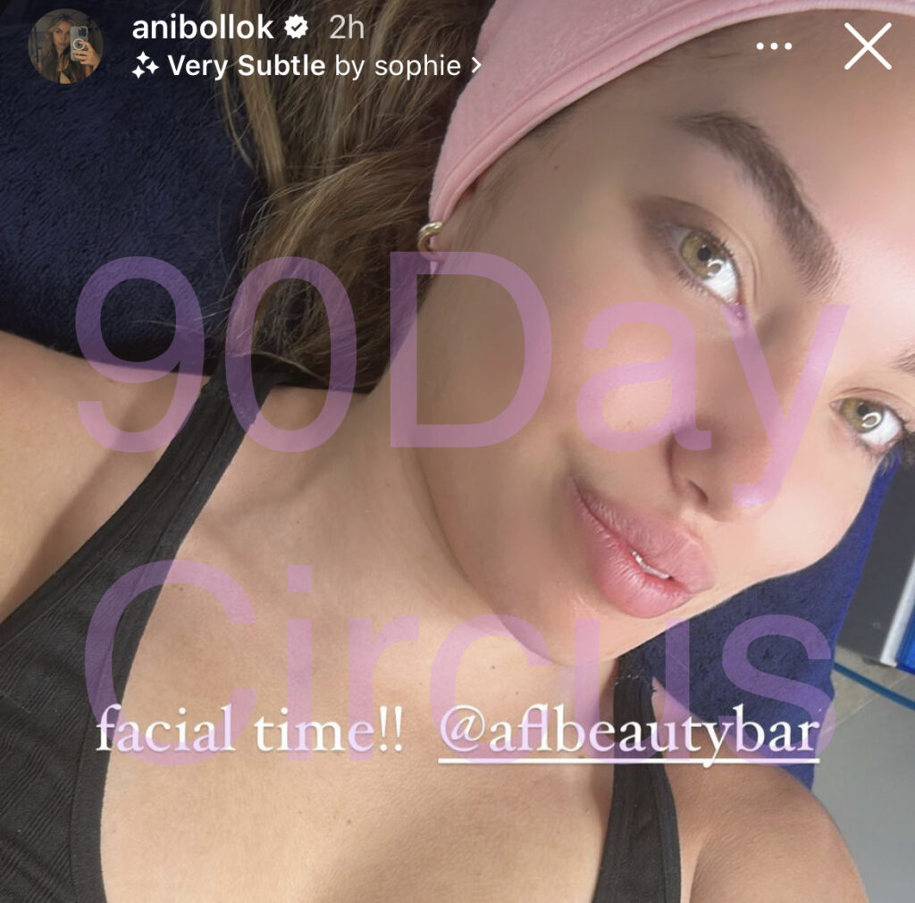 Darcey Silva daughter lip fillers