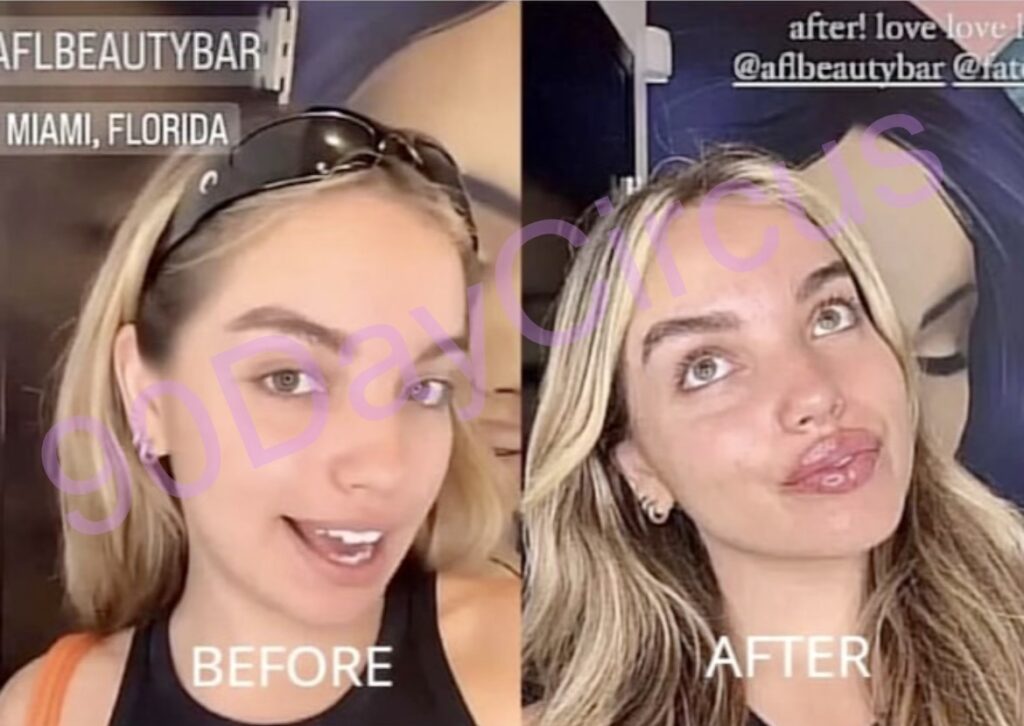 Darcey Silva daughter lip fillers