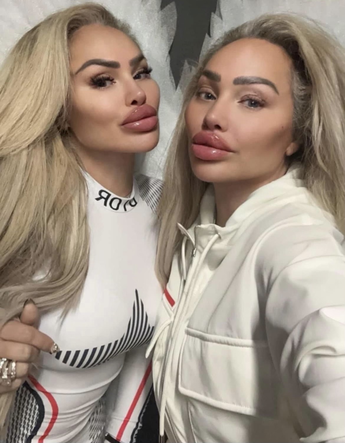 Darcey Silva Shocking Transformation With Ozempic